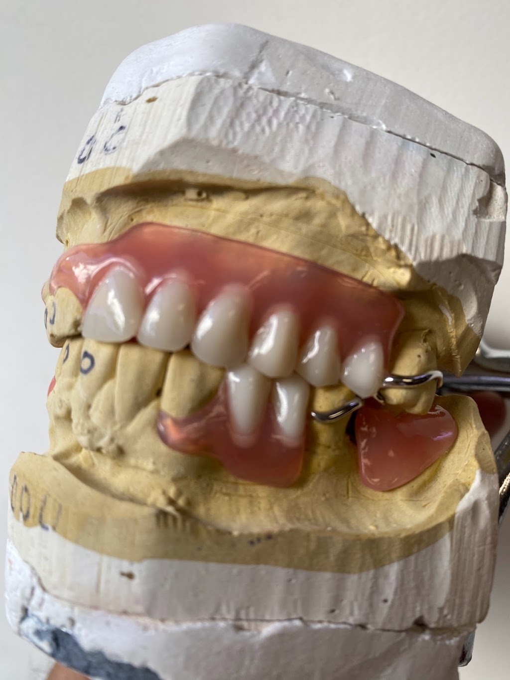 Martigon Dental Lab | 12684 Atherton Dr, Moreno Valley, CA 92555, USA | Phone: (951) 247-3459