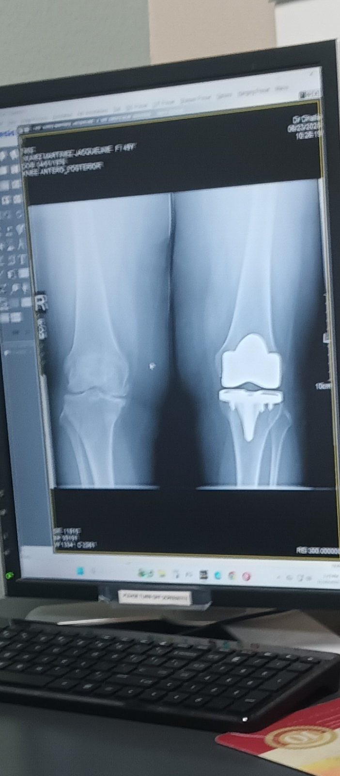 Dhalla Orthopedic Center, INC | 4343 Market St # A, Riverside, CA 92501, USA | Phone: (951) 787-4880