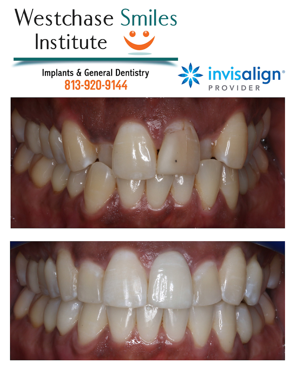 Westchase Smiles Institute | 9914 W Linebaugh Ave, Tampa, FL 33626, USA | Phone: (813) 544-2266