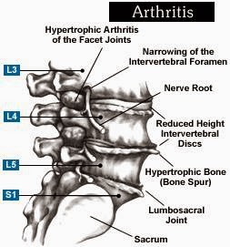 South Texas Spinal Clinic | 861 Landa St, New Braunfels, TX 78130, USA | Phone: (830) 203-6040