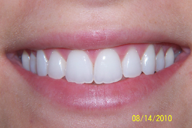 Designing Smiles | 13017 W Linebaugh Ave, Tampa, FL 33626, USA | Phone: (813) 891-1212