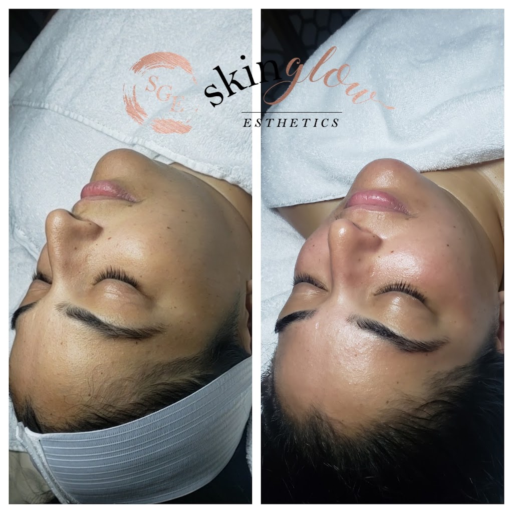 Skin Glow Esthetics | 380 Lowell St Suite 202B, Wakefield, MA 01880, USA | Phone: (978) 882-2833