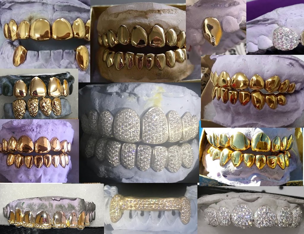 The Plug Custom Grillz | 3701 NW 9th Ave #3, Pompano Beach, FL 33064, USA | Phone: (561) 860-1364