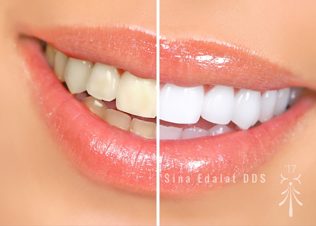 Sina Edalat, DDS | 5906 Monterey Rd, Los Angeles, CA 90042 | Phone: (323) 256-2680