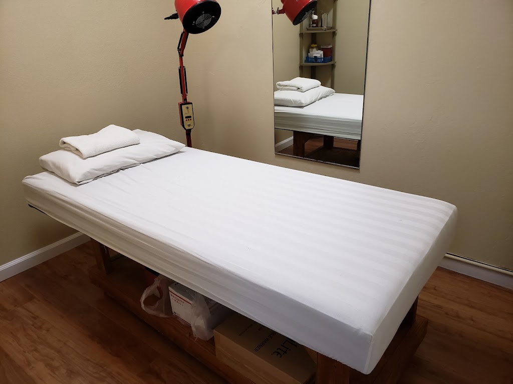 Spring Acupuncture 春纪中医 | 135 Dixon Rd, Milpitas, CA 95035, USA | Phone: (408) 945-1859