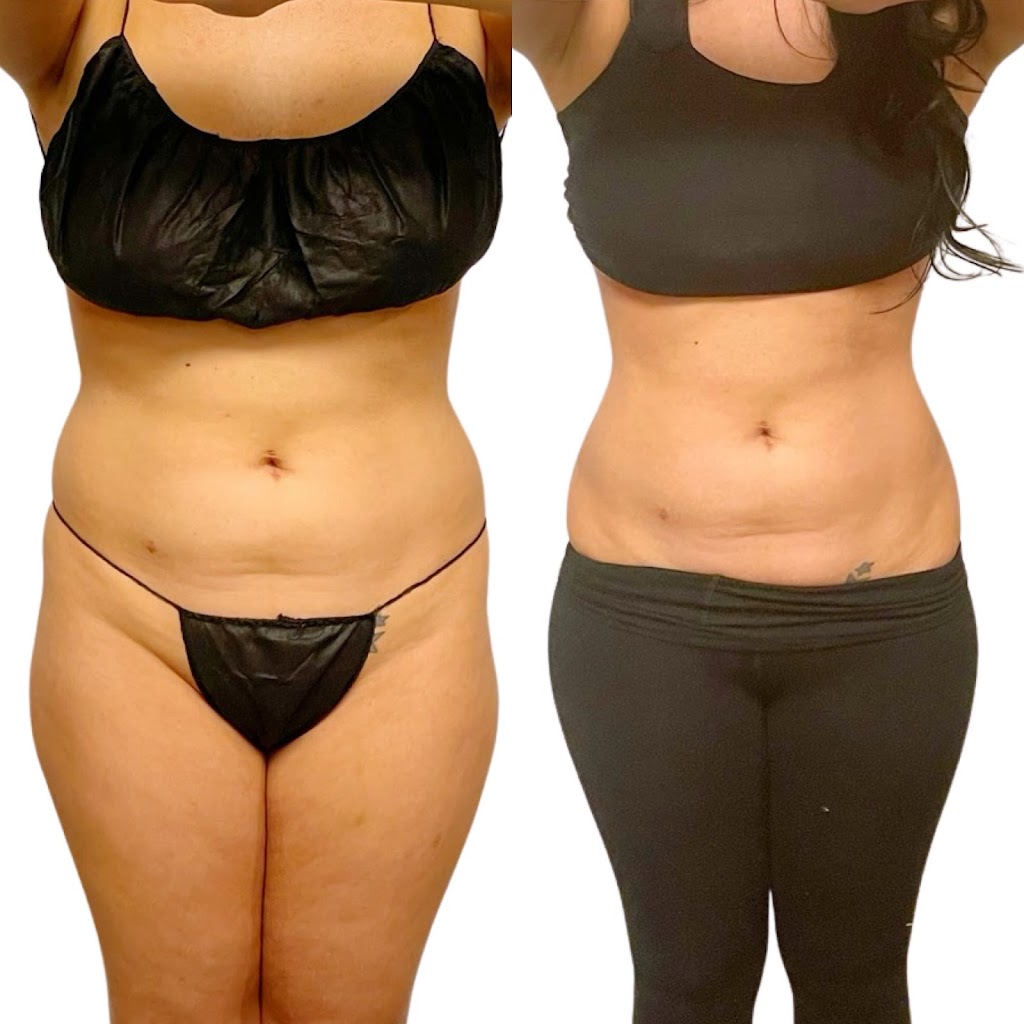 Sculpt Body Contouring & More | 609 N Pacific Coast Hwy Suite 121, Redondo Beach, CA 90277, USA | Phone: (424) 310-4219