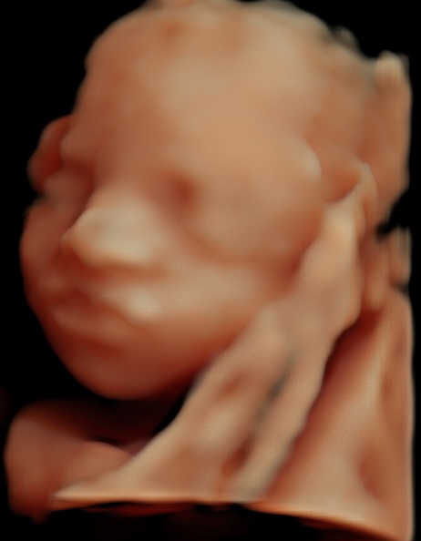 Print preview in Utero Photography 3d | 2901 Overland Trail Suite 100, Sherman, TX 75092, USA | Phone: (918) 348-9796