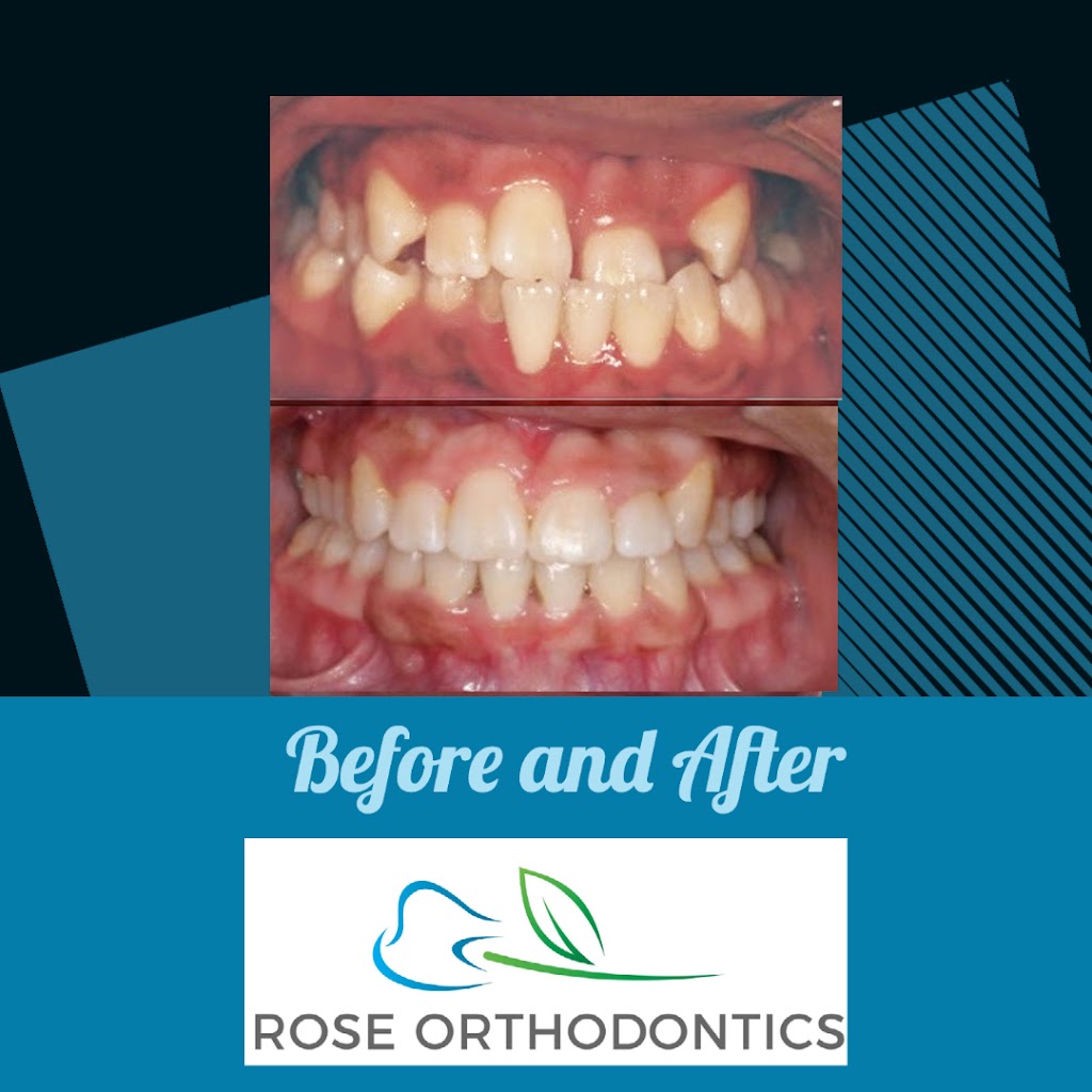 Rose Orthodontics: Aaron Rose, DMD, MS | 980 W Central Ave Suite D, Delaware, OH 43015 | Phone: (740) 272-4455