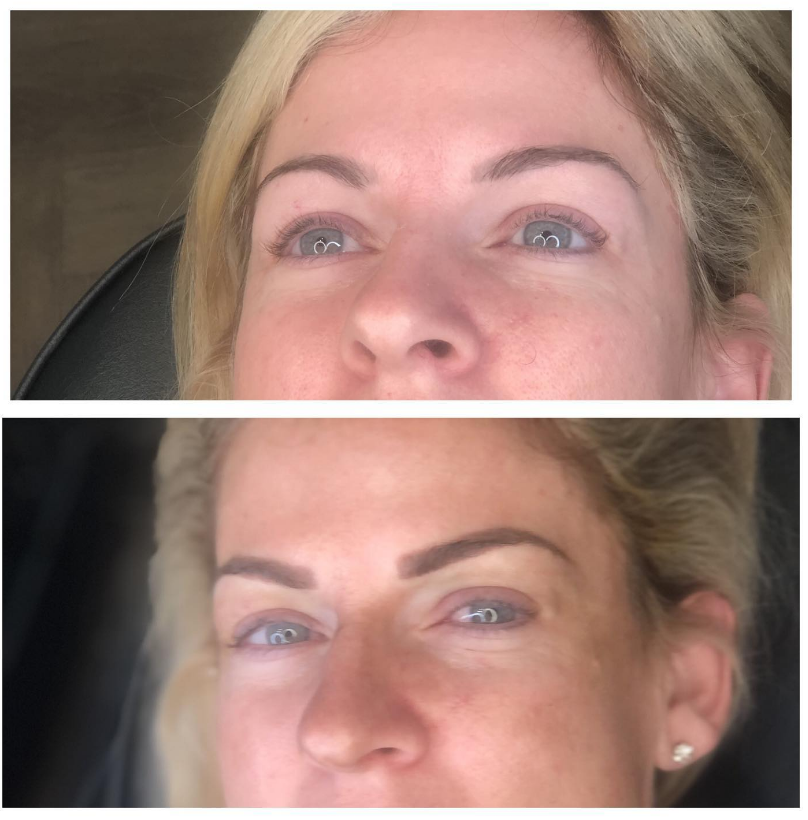Signature Brows and Skin | 8734 E Shea Blvd Suite 113, Scottsdale, AZ 85260, USA | Phone: (480) 247-3240 Signature Brows and Skin | 8734 E Shea Blvd Suite 113, Scottsdale, AZ 85260, USA | Phone: (480) 247-3240