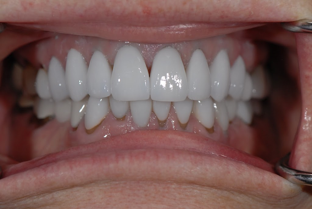 Prestige Line Dental Studio | 6011 Morriss Rd Suite 100, Flower Mound, TX 75028, USA | Phone: (469) 630-0186