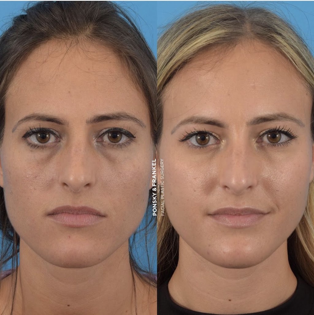 Frankel Facial Plastic Surgery, LLC: Jonathan Frankel, MD | 5885 Landerbrook Dr Suite 150, Mayfield Heights, OH 44124, USA | Phone: (216) 399-9550