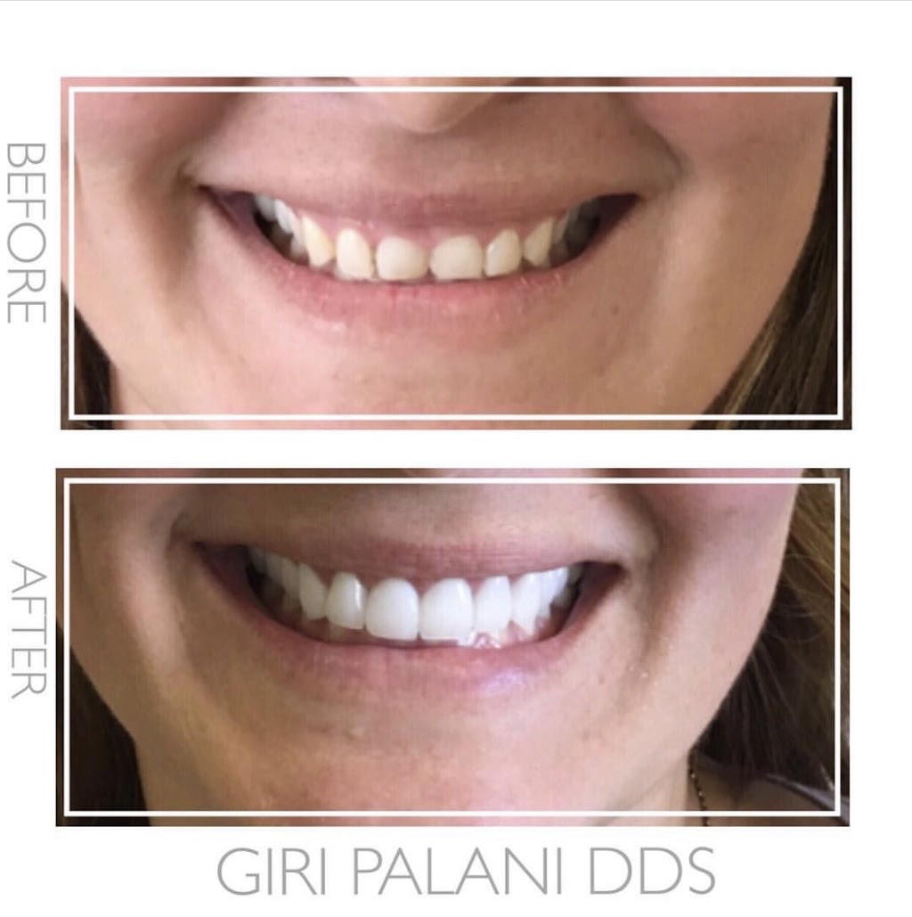 Palani Center For Dental Implants | 28358 S Western Ave, Rancho Palos Verdes, CA 90275, USA | Phone: (213) 725-2086