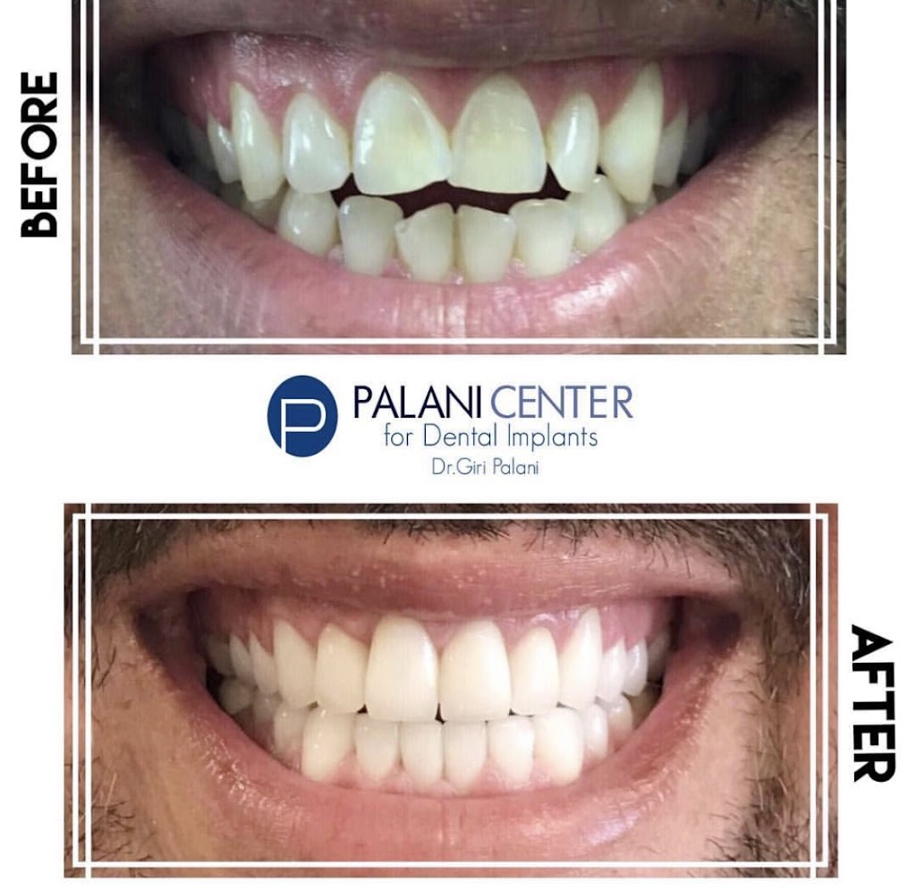 Palani Center For Dental Implants | 28358 S Western Ave, Rancho Palos Verdes, CA 90275, USA | Phone: (213) 725-2086