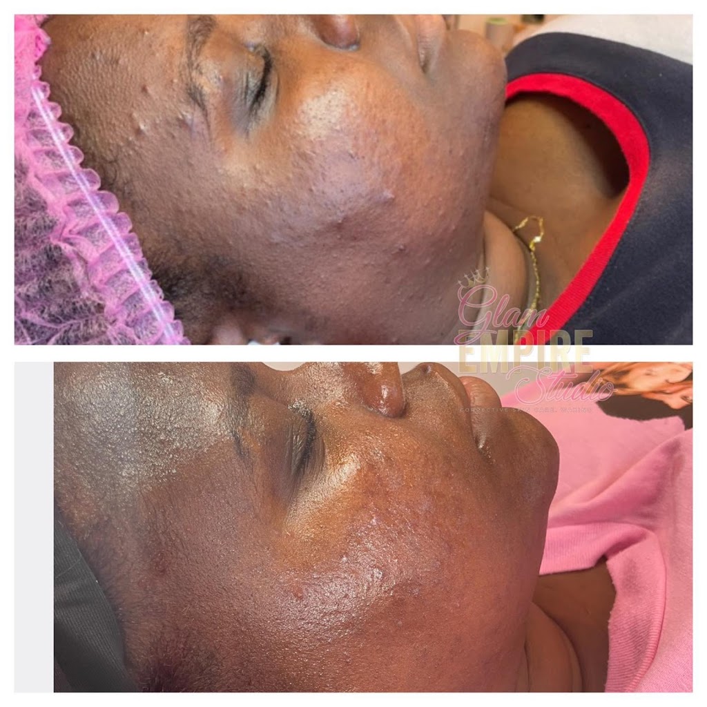 Glam Empire Studio LLC- Corrective Skin Care & Waxing | 213 Old Padonia Rd #2, Cockeysville, MD 21030, USA | Phone: (443) 826-0846