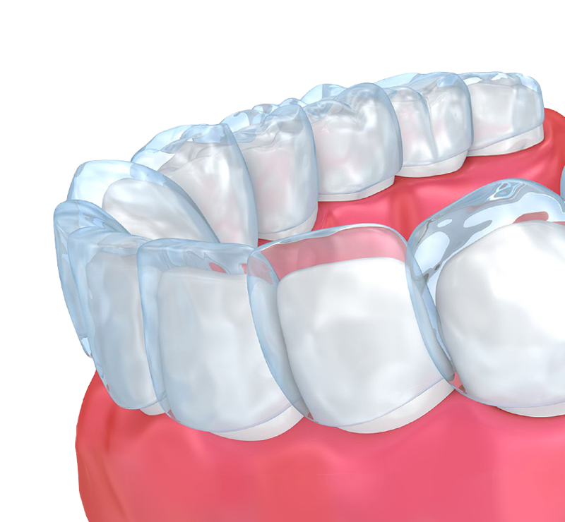 Pinnacle Dental | 2552 Stonebrook Pkwy suite a 650, Frisco, TX 75034, USA | Phone: (469) 421-8161