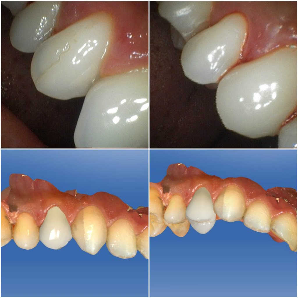 Arnel Lee and Gary Lum, DDS | 10251 Torre Ave STE 228, Cupertino, CA 95014, USA | Phone: (408) 255-0329