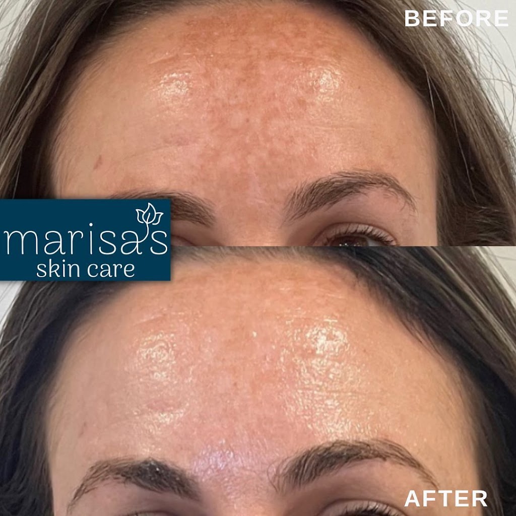 Marisas Skin Care | 844 E Washington St, North Attleborough, MA 02760, USA | Phone: (774) 643-6180