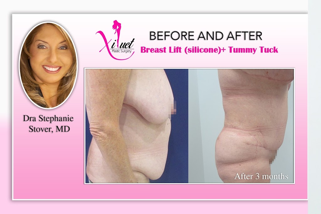 Dr. Stephanie A. Stover, MD | 8396 SW 8th St 1st floor, Miami, FL 33144 | Phone: (305) 615-4200