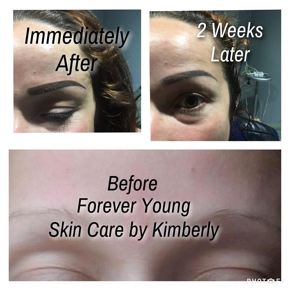 Forever Young Skin Care & Laser By Kimberly | 4411 Suwanee Dam Rd STE 515, Suwanee, GA 30024 | Phone: (470) 800-3552