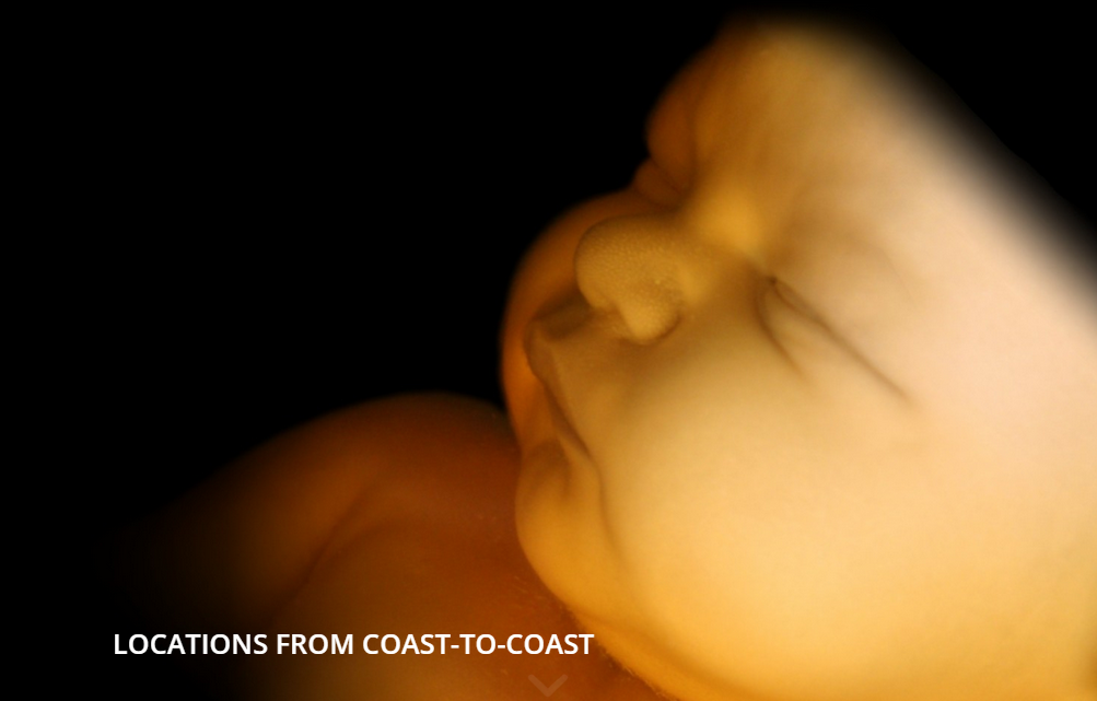 Prenatal Peek 3D/4D Ultrasound | 841 S Glendora Ave, West Covina, CA 91790, USA | Phone: (626) 935-5684