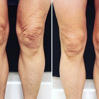 Rejuvenate & Wellness Center Lakeland | 4019 US Hwy 98 N Suite 124, Lakeland, FL 33809, USA | Phone: (321) 294-3586