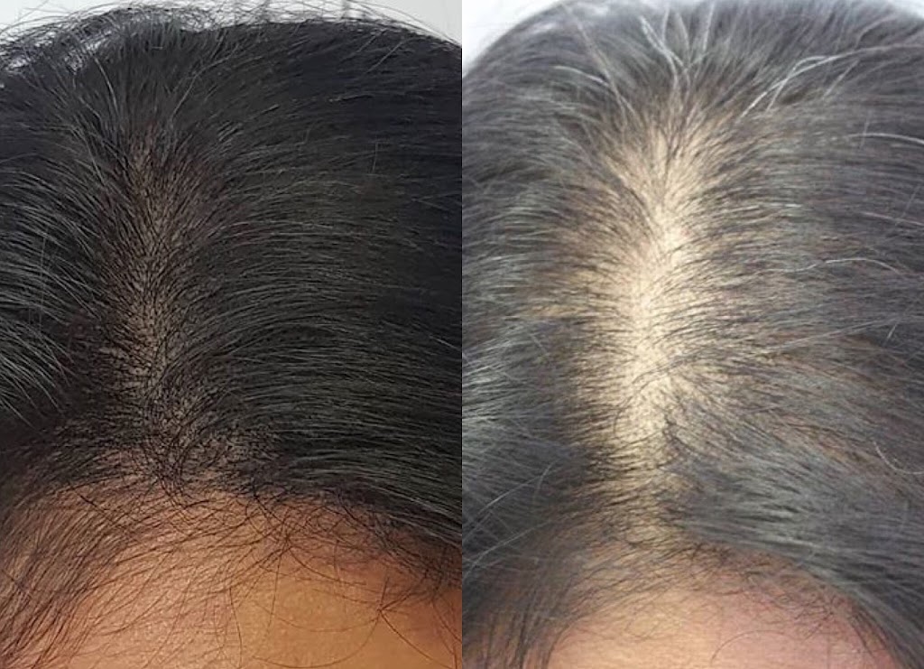 Hair Recovery Treatment Center | 1523 S La Cienega Blvd, Los Angeles, CA 90035, USA | Phone: (424) 600-8484