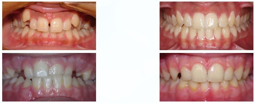 Central Texas Orthodontics - Dr. Brian St.Louis | 3413 W Slaughter Ln, Austin, TX 78748, USA | Phone: (512) 292-1910