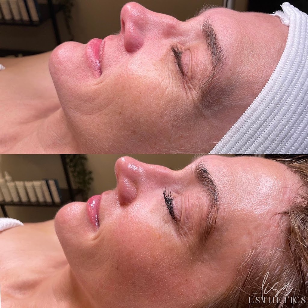 Lisa Esthetics | 5809 Bardstown Rd, Louisville, KY 40291, USA | Phone: (859) 913-9158