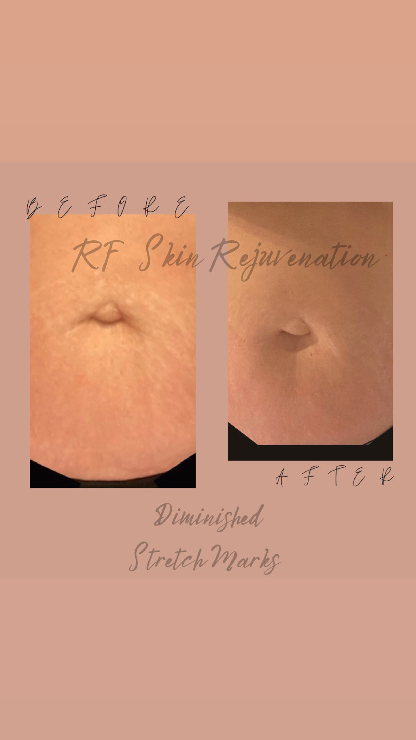 Re’Vive Aesthetics Spa | 2364 Will Carleton Rd, Flat Rock, MI 48134, USA | Phone: (734) 355-2274