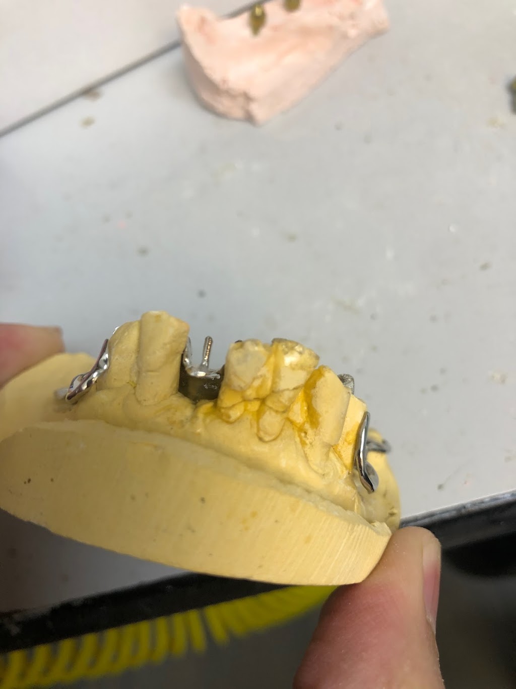 A & M Dental Laboratories Inc | 425 S Santa Fe St, Santa Ana, CA 92705, USA | Phone: (714) 547-8051