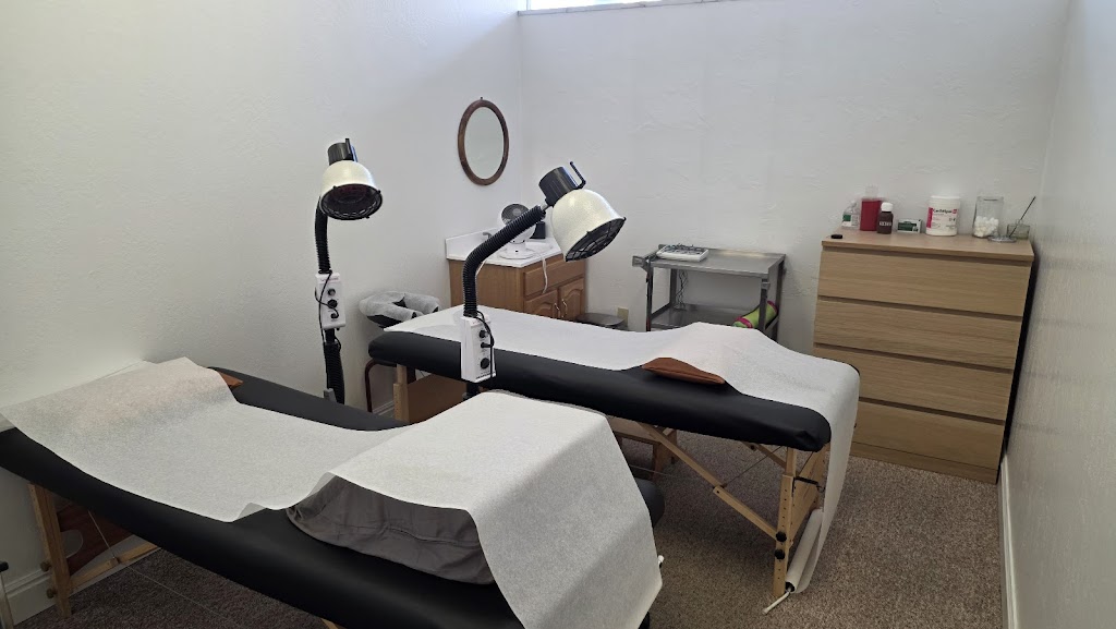 Happy Acupuncture & Herb | 2322 Butano Dr #107, Sacramento, CA 95825, USA | Phone: (916) 201-5457