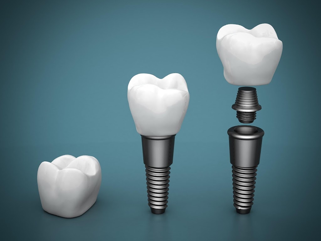 Brentwood Family Dentistry | 8824 Litzsinger Rd, Brentwood, MO 63144, USA | Phone: (314) 461-1878