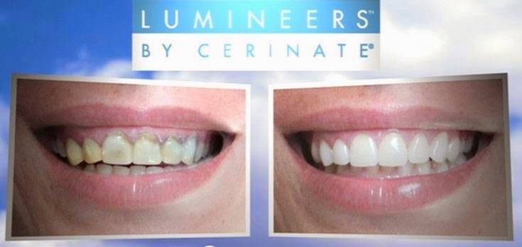 Thanh-Truc Nguyen, DDS | 5400 Park Dr #100, Rocklin, CA 95765, USA | Phone: (916) 435-1155