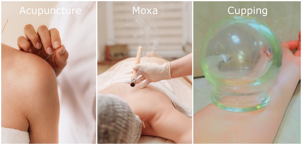 Sina Acupuncture: Dr.Hashemipour (Dr.H), L.Ac, clinical PhD | 17 Rodman Oval, New Rochelle, NY 10805, USA | Phone: (631) 507-4845