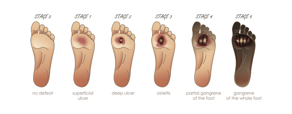 Dr. Gregory E. Neal, MD, FACS | Wound Care are TriStar Centennial Medical Center 2400 Patterson Street |, Suite 304, Nashville, TN 37203, USA | Phone: (615) 865-0700