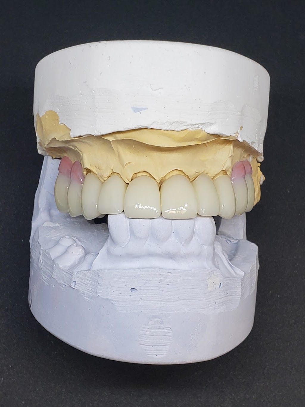 3D Dental Lab Inc | 2427 Baker Dr suite a, Mesquite, TX 75150, USA | Phone: (972) 270-9995