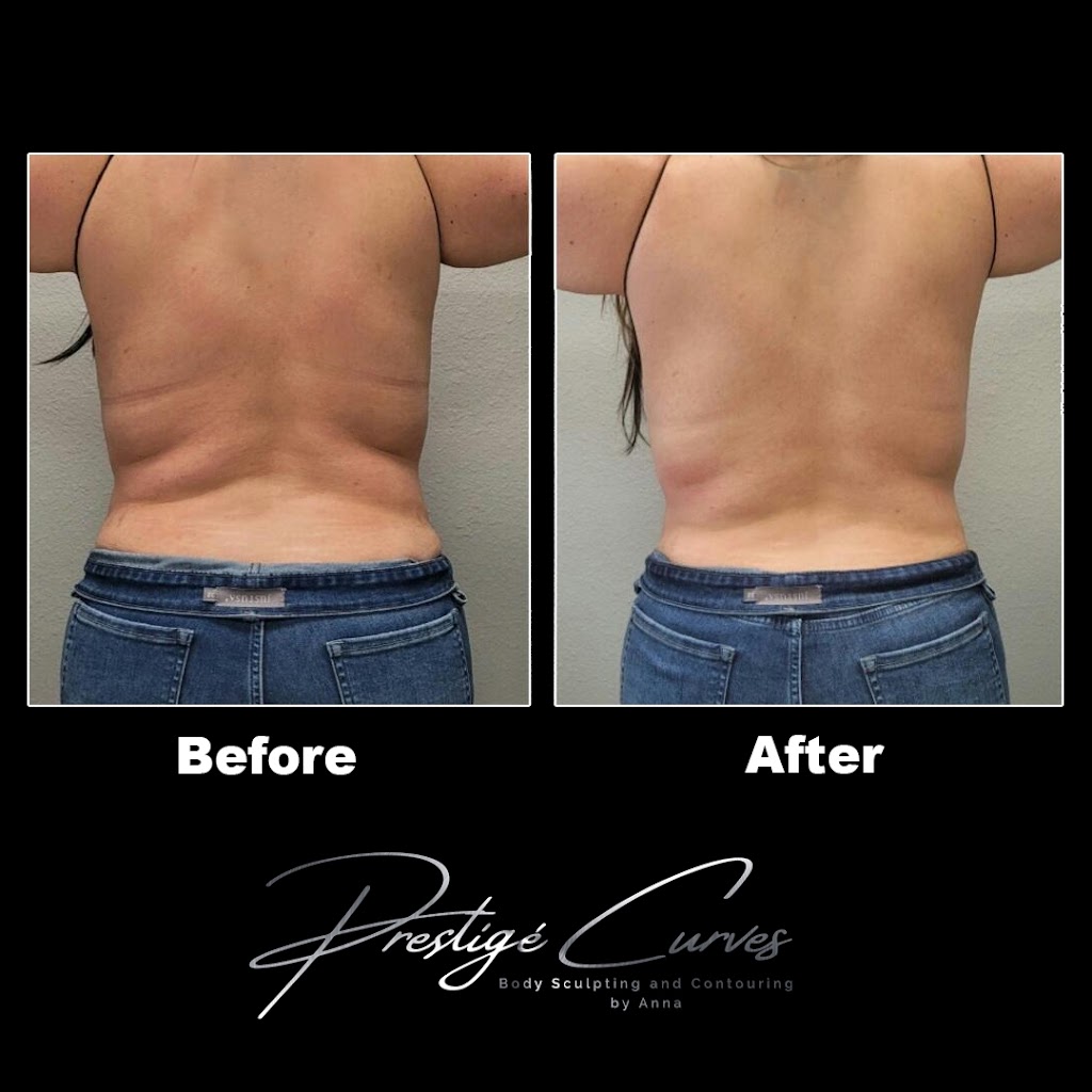 Prestigé Curves Body Sculpting | 520 W Lacey Blvd #3, Hanford, CA 93230, USA | Phone: (559) 904-9943