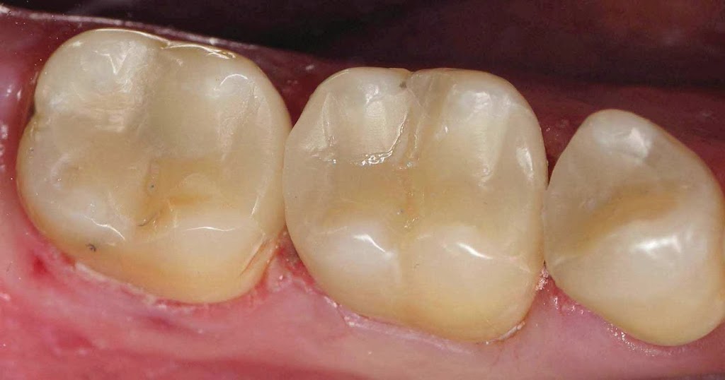 Sumiton Dental | 44 Oak Dr, Sumiton, AL 35148, USA | Phone: (205) 648-3212