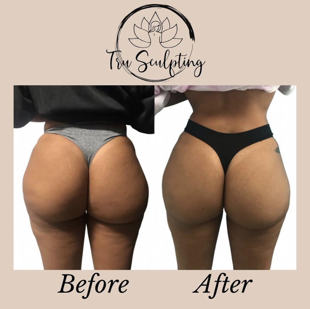 Tru Sculpting Health & Beauty | 2201 E Willow St # H, Signal Hill, CA 90755, USA | Phone: (562) 481-4392 Tru Sculpting Health & Beauty | 2201 E Willow St # H, Signal Hill, CA 90755, USA | Phone: (562) 481-4392