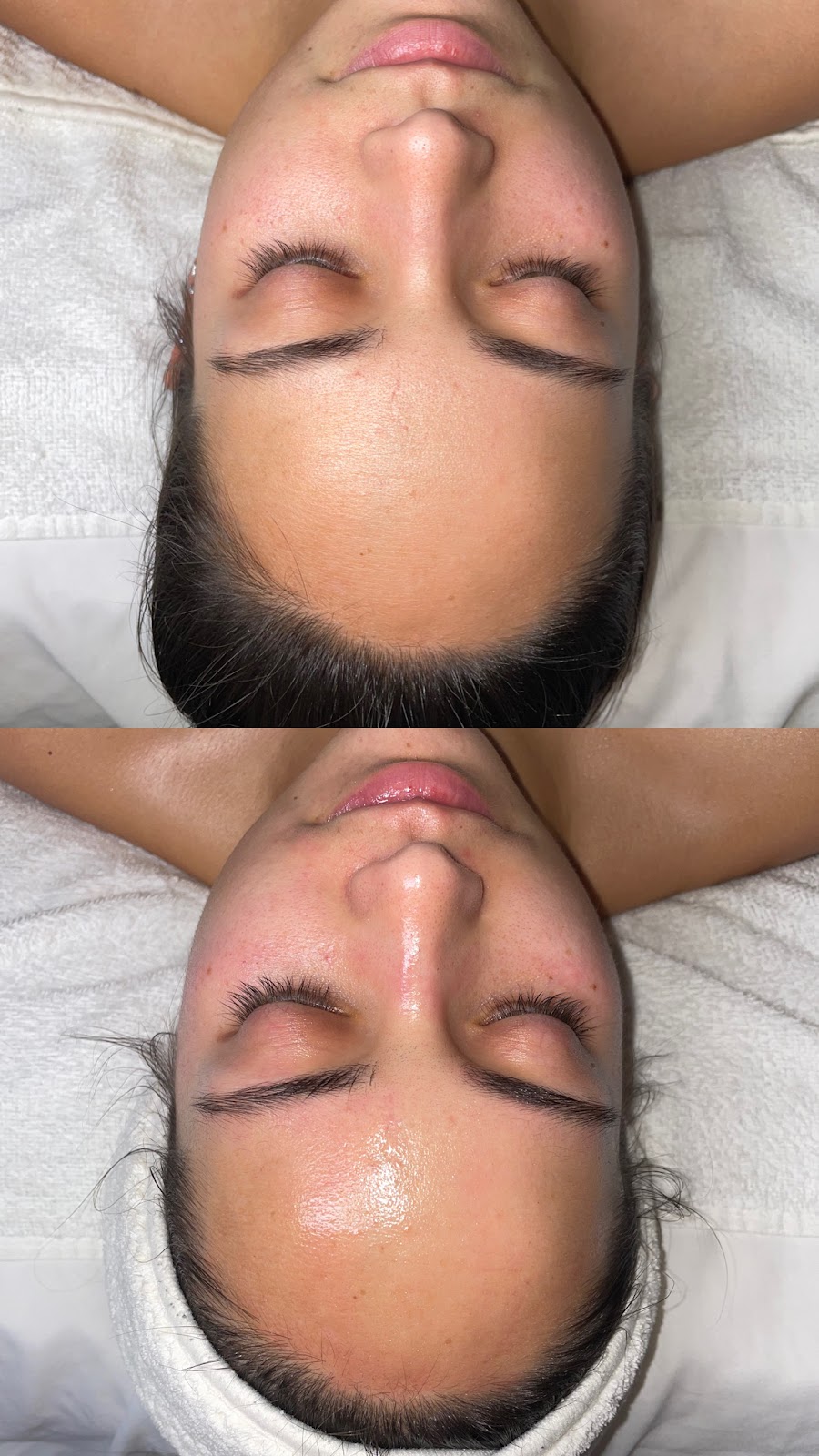 Skin aesthetics by Erika | 6693 Folsom-Auburn Rd, Folsom, CA 95630, USA | Phone: (916) 305-9100