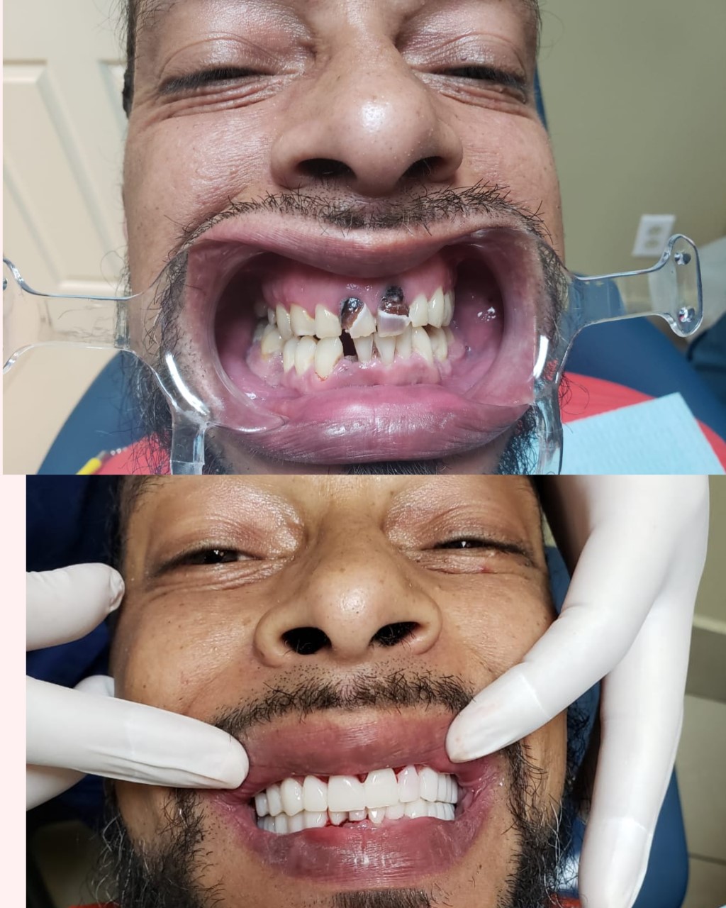 Liberty Dental Clinic | Av. Francisco I. Madero 8251, Zona Centro, 22000 Tijuana, B.C., Mexico | Phone: (619) 308-7948