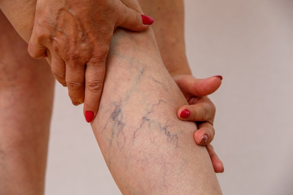 Vein Pain Physicians | 300 S Nolen Dr, Southlake, TX 76092, USA | Phone: (972) 433-0092