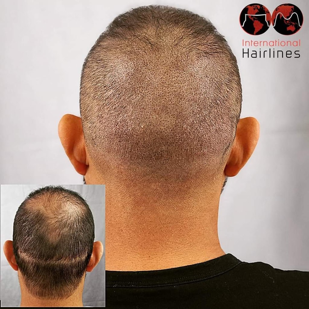 Pittsburgh International Hairlines | 2001 Montour Church Rd Second Floor, Oakdale, PA 15071, USA | Phone: (877) 567-3709