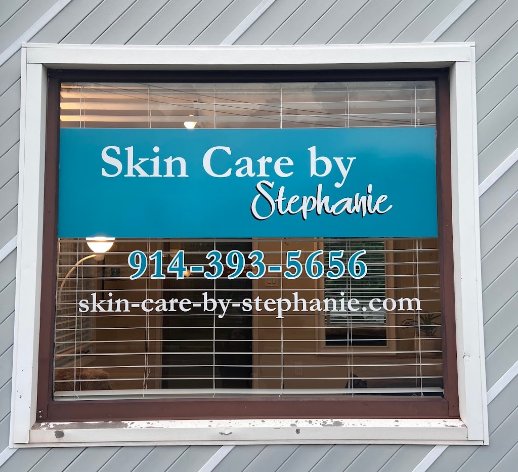 Skin Care by Stephanie | 1903 E Main St, Mohegan Lake, NY 10547, USA | Phone: (914) 393-5656
