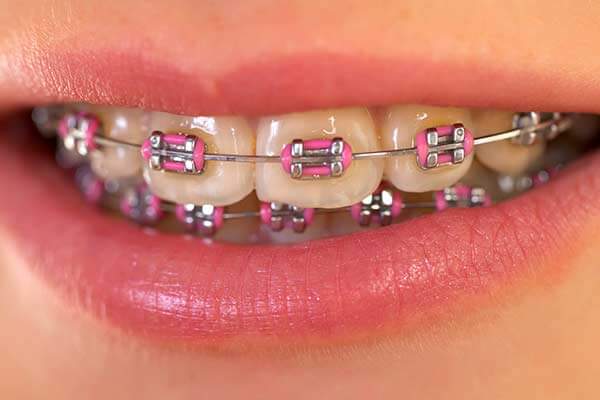 Garrick F. Wong DMD Orthodontics | 453 E Putnam Ave 2nd Floor, Cos Cob, CT 06807, USA | Phone: (203) 625-9888