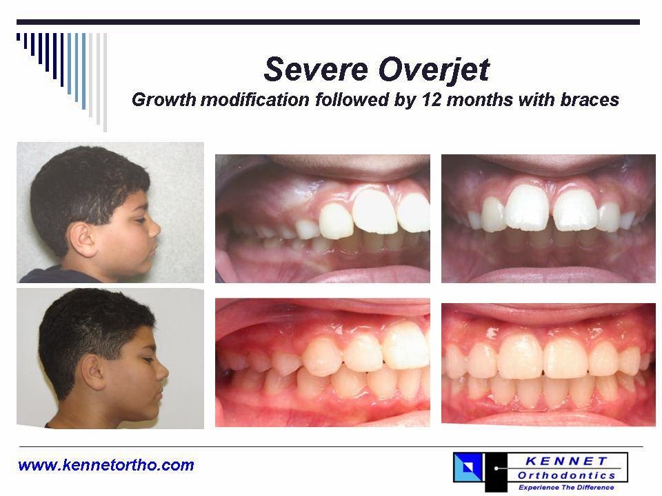 Dr. Zvi Kennet, Orthodontist | 19991 Hall Rd, Clinton Twp, MI 48038, USA | Phone: (586) 416-4422