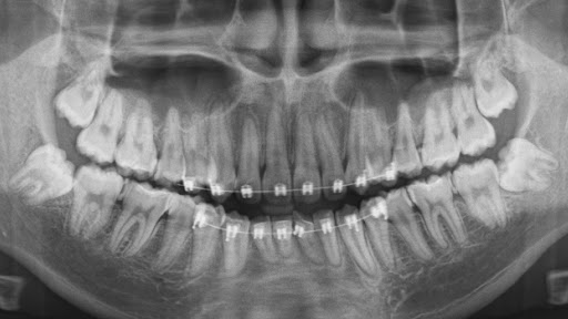 McKee Dental X-Ray | 2344 McKee Rd #30, San Jose, CA 95116, USA | Phone: (408) 251-5112