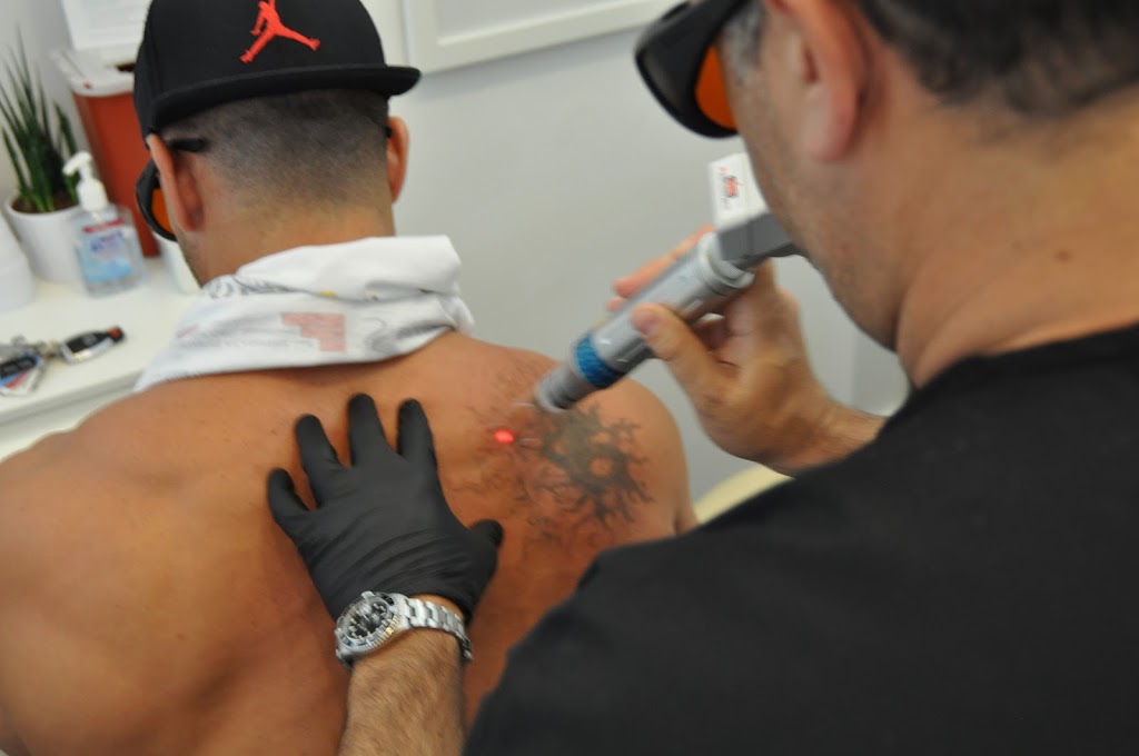 ReversaTatt Tattoo Removal | 8788 State Road 70 E UNIT 103, Bradenton, FL 34202, USA | Phone: (941) 300-0220