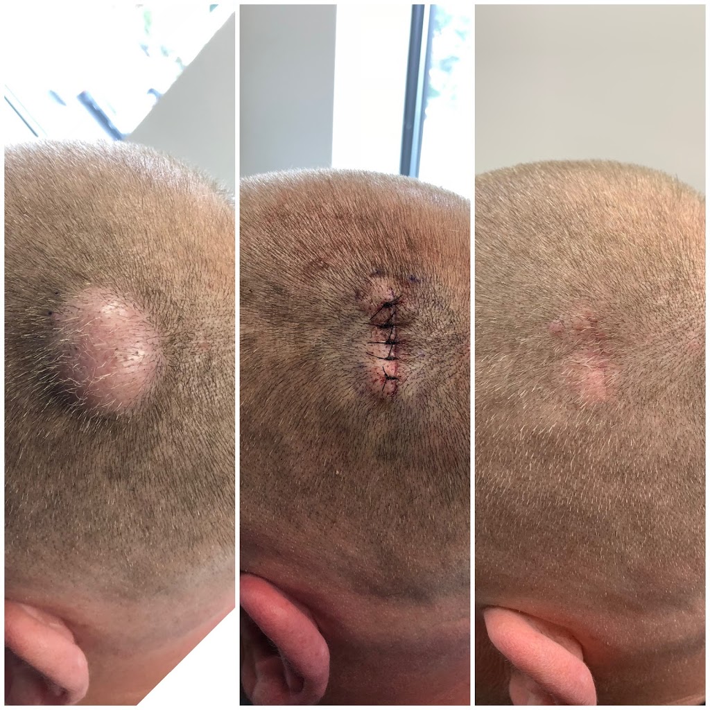 Geria Dermatology | 75 Orient Way Suite 204, Rutherford, NJ 07070, USA | Phone: (201) 623-8000
