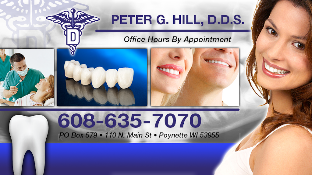 Peter G Hill DDS | 110 N Main St, Poynette, WI 53955, USA | Phone: (608) 635-7070